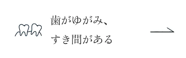 歯がゆがみ、すき間がある